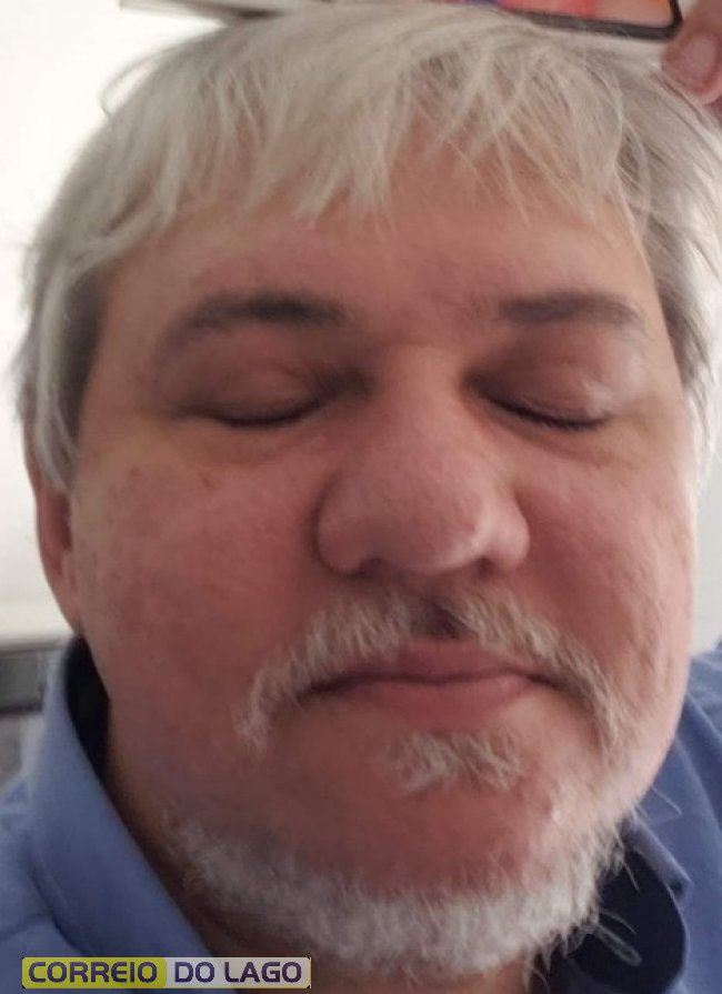 Luciano antes do projeto de emagrecimento